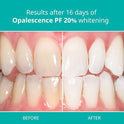 Opalescence PF 20% MINT flavor Tooth Whitening Gel - by Opalescence