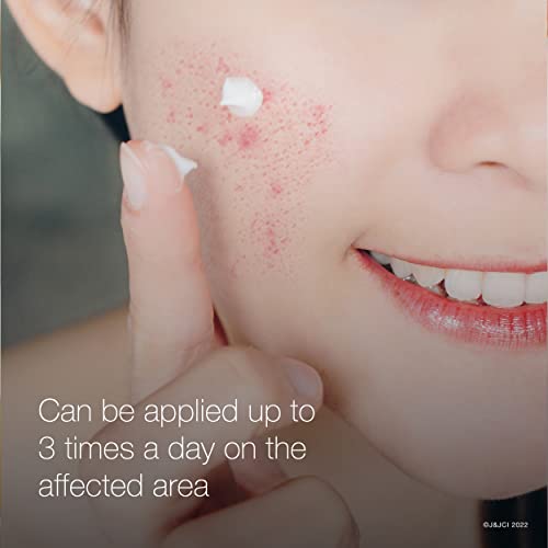 Neutrogena Rapid Clear Acne Eliminating Spot Gel With Salicylic Acid, 0.5 Fl. Oz. (Pack of 3)