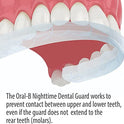 Oral-B Protector dental nocturno, menos de 3 minutos para una protección personalizada de molienda de dientes con alcance de sabor a menta, fabricado en una instalación auditada por la FDA en Estados Unidos
