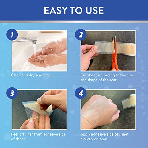 Aroamas Scar Hojas de silicona para eliminar cicatrices de cicatriz, cinta de silicona de 4 x 152 cm para suavizar y aplanar cicatrices, acné, cesárea, cirugía de queloide, extracción sin dolor, reutilizable, lavable, suministro de 6 a 8 meses