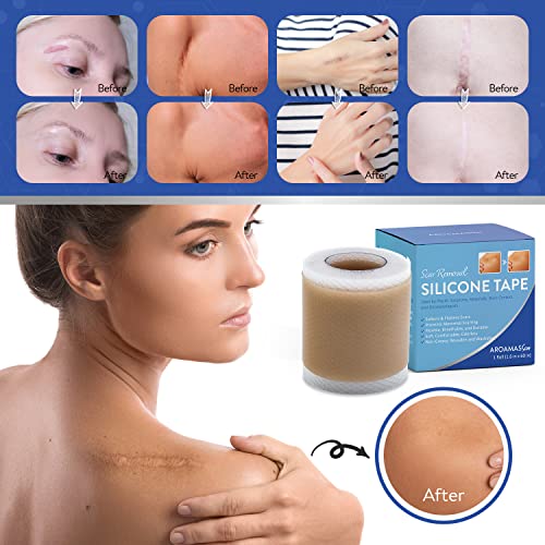 Aroamas Scar Hojas de silicona para eliminar cicatrices de cicatriz, cinta de silicona de 4 x 152 cm para suavizar y aplanar cicatrices, acné, cesárea, cirugía de queloide, extracción sin dolor, reutilizable, lavable, suministro de 6 a 8 meses