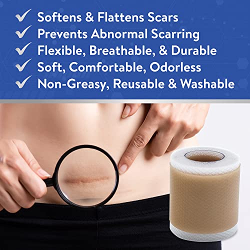Aroamas Scar Hojas de silicona para eliminar cicatrices de cicatriz, cinta de silicona de 4 x 152 cm para suavizar y aplanar cicatrices, acné, cesárea, cirugía de queloide, extracción sin dolor, reutilizable, lavable, suministro de 6 a 8 meses