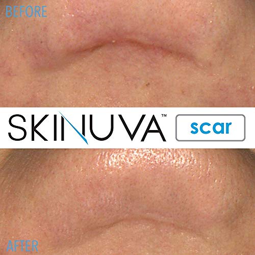 Skinuva - Crema para cicatrices de última generación, crema avanzada para eliminar cicatrices formulada con factores de crecimiento. (50,27 ml)