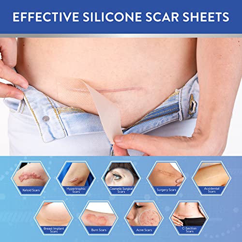 Aroamas Scar Hojas de silicona para eliminar cicatrices de cicatriz, cinta de silicona de 4 x 152 cm para suavizar y aplanar cicatrices, acné, cesárea, cirugía de queloide, extracción sin dolor, reutilizable, lavable, suministro de 6 a 8 meses