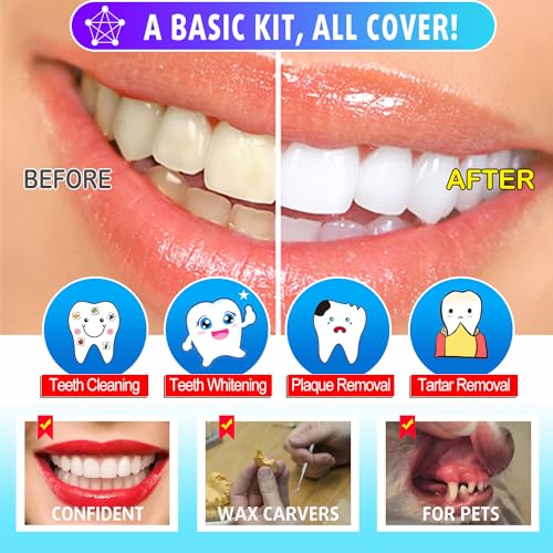 Herramientas dentales, 6 unidades de herramientas de limpieza de dientes de acero inoxidable, removedor de sarro raspador de placa raspador de dientes con espejo de boca, kit de pinzas para dentista, cuidado bucal familiar, perros