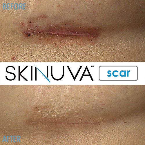 Skinuva - Crema para cicatrices de última generación, crema avanzada para eliminar cicatrices formulada con factores de crecimiento. (50,27 ml)